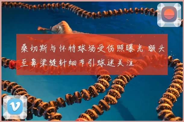 桑切斯与怀特球场受伤照曝光 额头至鼻梁缝针细节引球迷关注