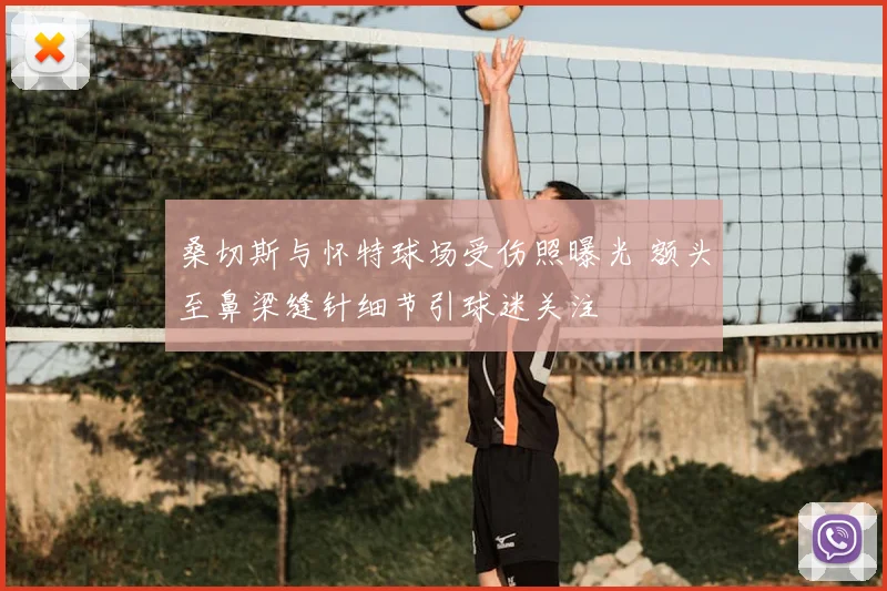 桑切斯与怀特球场受伤照曝光 额头至鼻梁缝针细节引球迷关注